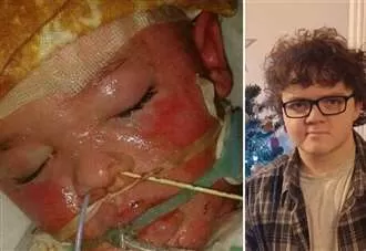 ‘I want to find a cure so no child goes through what I did’