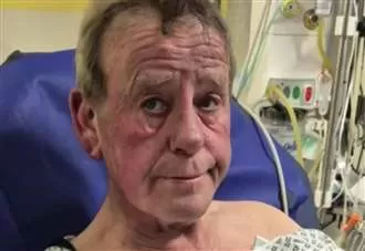 Dad suffers second-degree burns as candle sparks devastating house fire